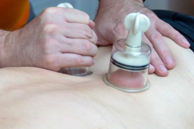 Leistungsangebot - Schröpfmassage - Gregor Schlüter Praxis für Physiotherapie, Manuelle Therapie, Osteopathie & Prävention